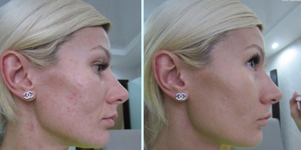 Dermacol - ультрамаскирующий тональный крем